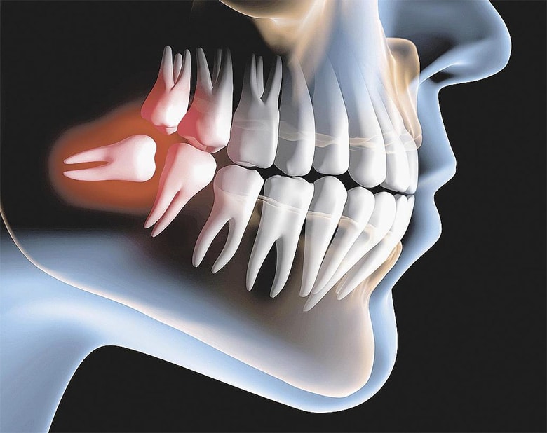 cirurgia_oral_rthomay