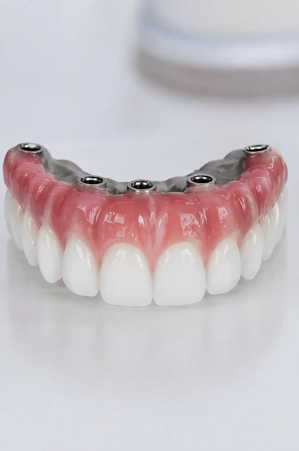 Prótese protocolo fixa sobre implantes dentários