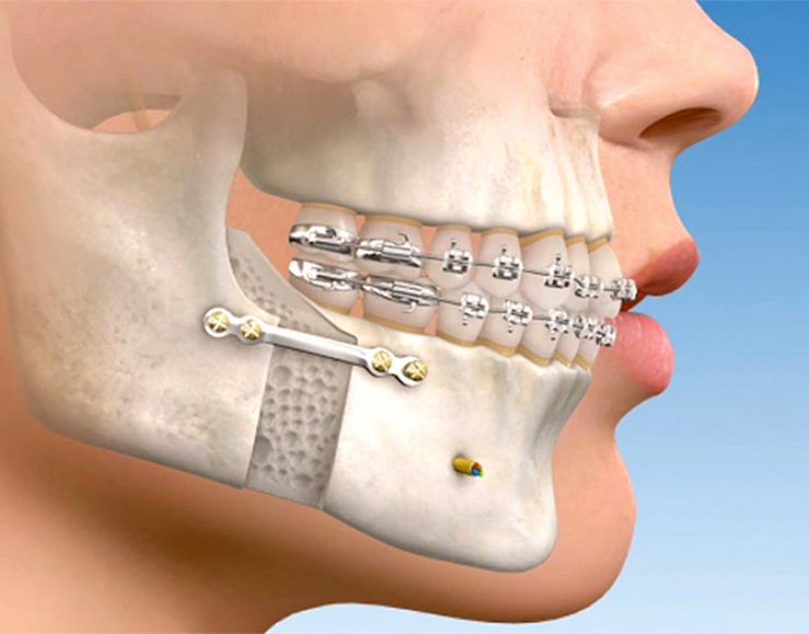 cirurgia_orthomay